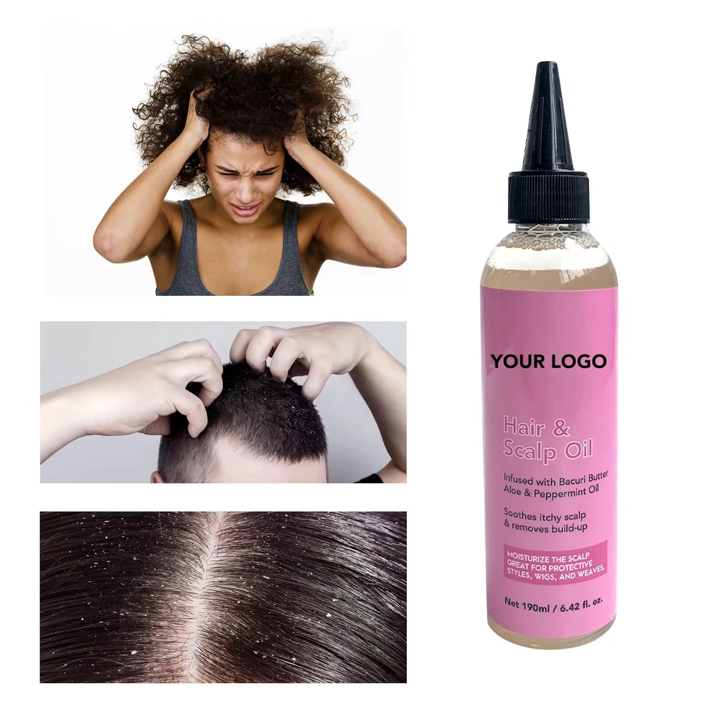 100pcs Private Label Anti-Dandruff & Anti-Itch Scalp Nourishing Hair Care Essence Oil