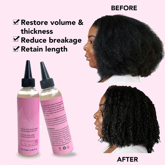 100pcs Private Label Anti-Dandruff & Anti-Itch Scalp Nourishing Hair Care Essence Oil