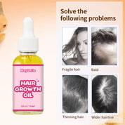 50pcs Private Label Hair Growth Oil